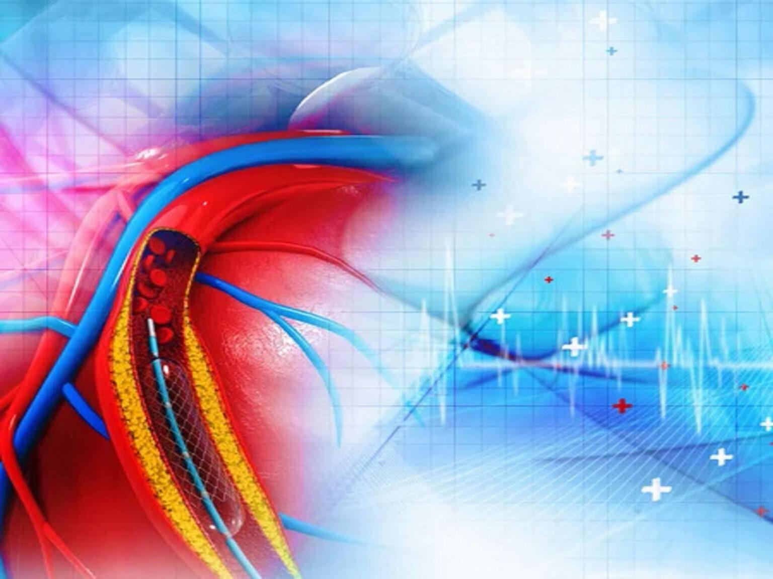 coronary-angioplasty-dr-nikhil-motiramani